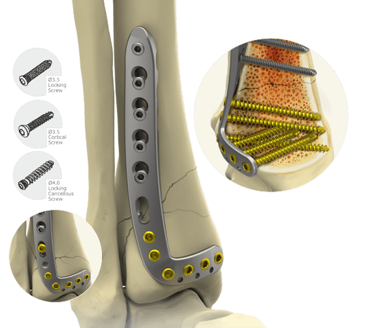 hilusolmedics About Us